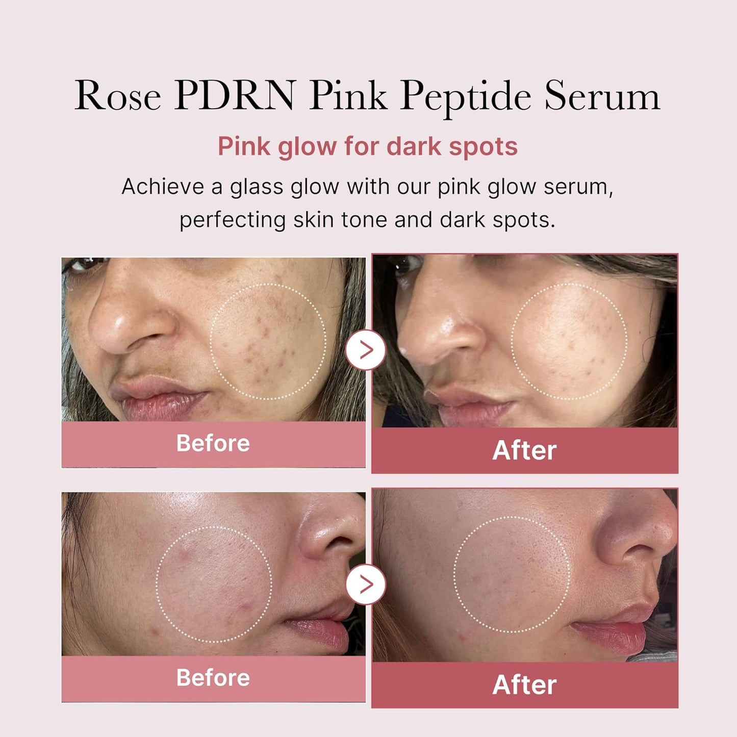 Medicube DNA PDRN Pink Peptide Serum, Pink glow serum, Peptide, Niacinamide, Hydrating & Moisturizing & Firming, Uneven Skin Tone, Korean Skincare